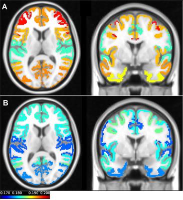 Functional MRI Signal Complexity Analysis Using Sample Entropy